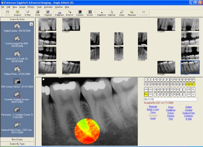 Tab32 dental software